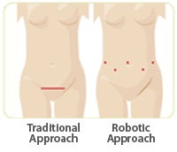 Urogynecology Robotic Surgery