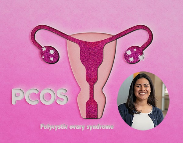 PCOS graphic