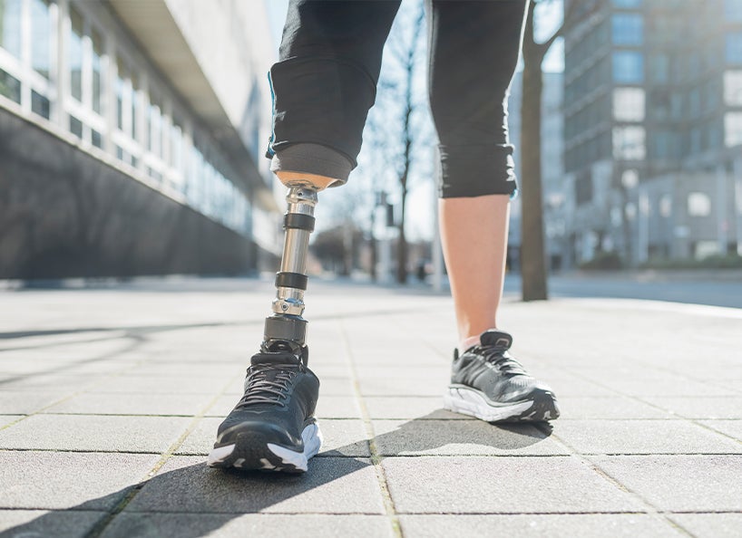 Prosthetic Leg