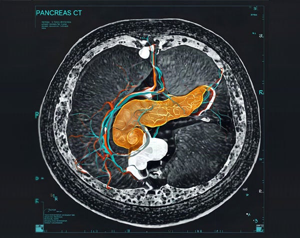 Pancreas360