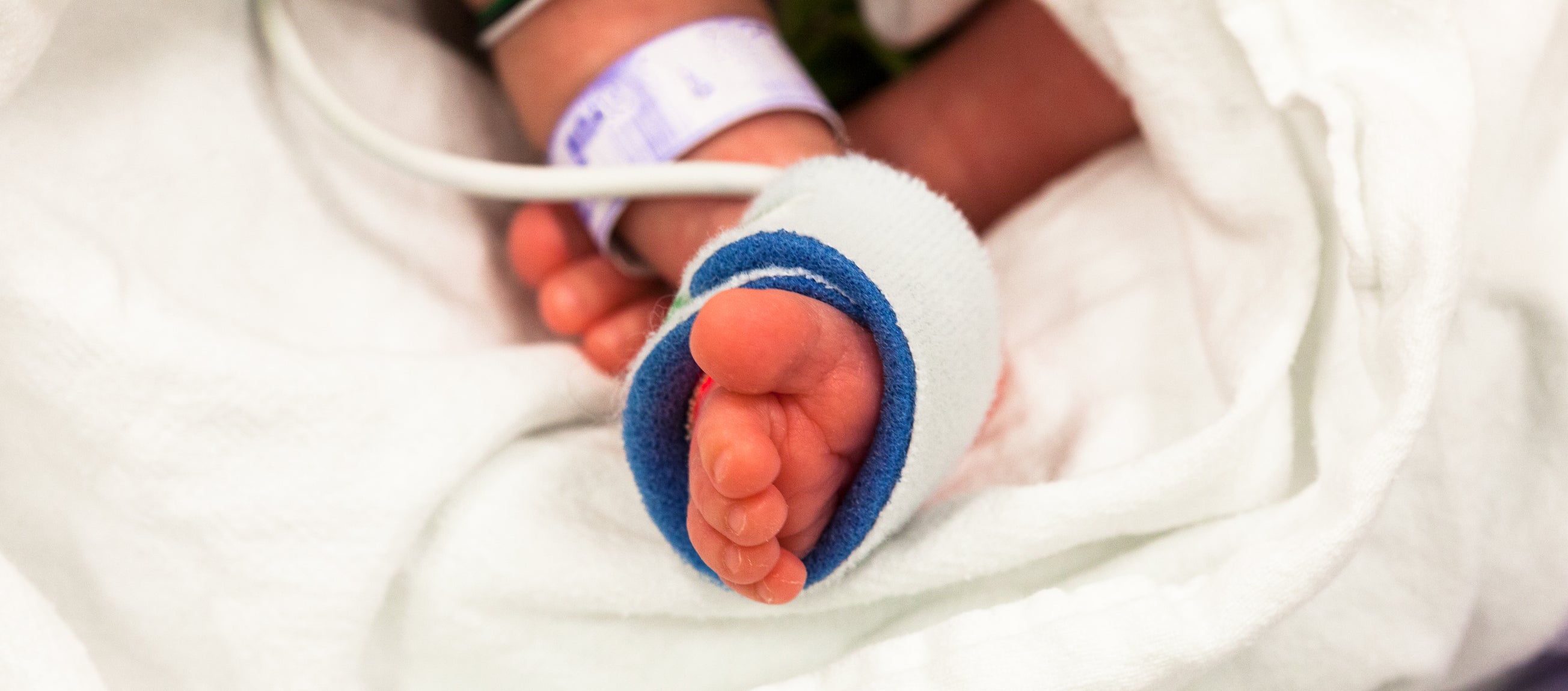 Foot of a premature baby in the neonatal intensive care unit