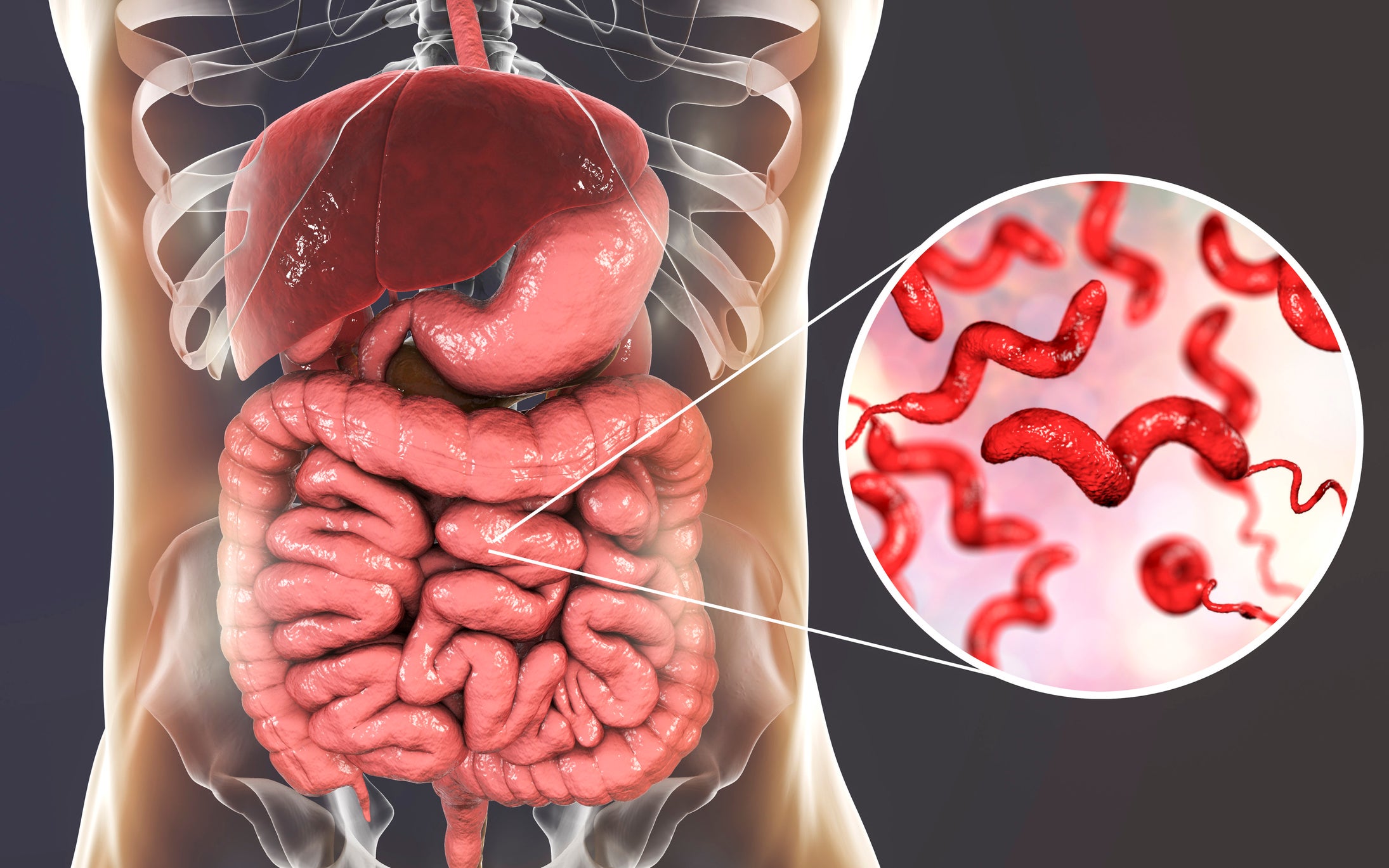 Campylobacteriosis, conceptual illustration