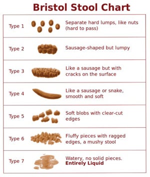Constipation stool chart