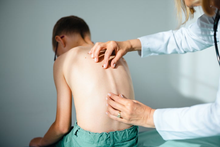 boy having spine checked for scoliosis