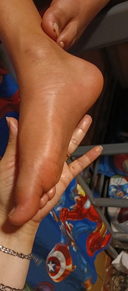 joel's swollen foot