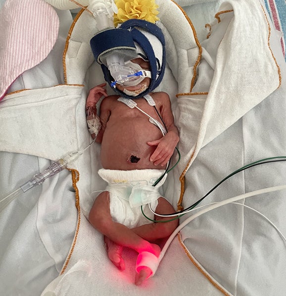 baby in NICU