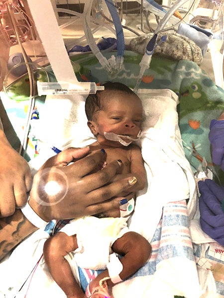 Trey in the NICU