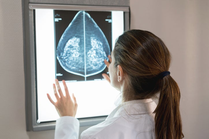 doctor looking at mammogram image
